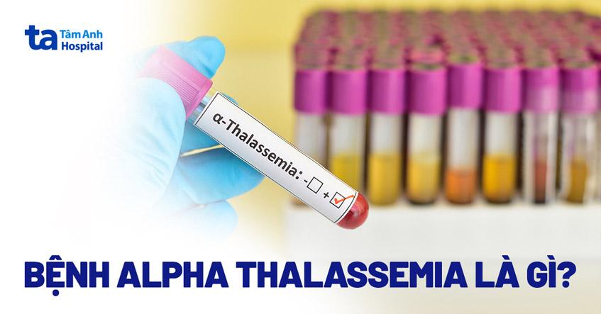Bệnh alpha Thalassemia: Nguyên nhân, triệu chứng, chẩn đoán, phòng ngừa